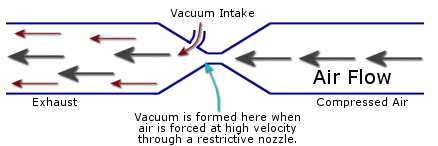 manual vacuum aspiration side effects